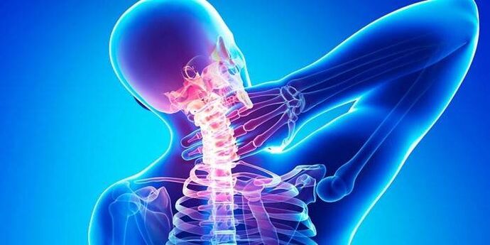 dzemdes kakla osteohondroze