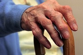 bojājumi pirkstiem ar artrozi
